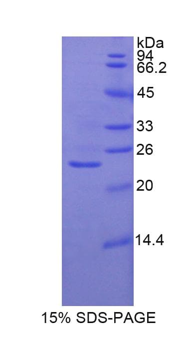 Rat GSS / Glutathione Synthetase Protein (Recombinant His)