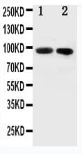 FER Antibody (aa521-536)