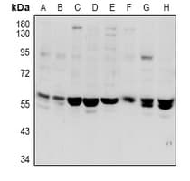 Polyclonal Rabbit anti-Human VANGL1 Antibody (WB)