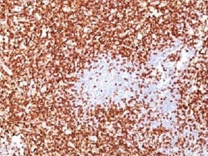 CD45RO Antibody (clone UCHL-1 + T200/797, Ready-to-Use)