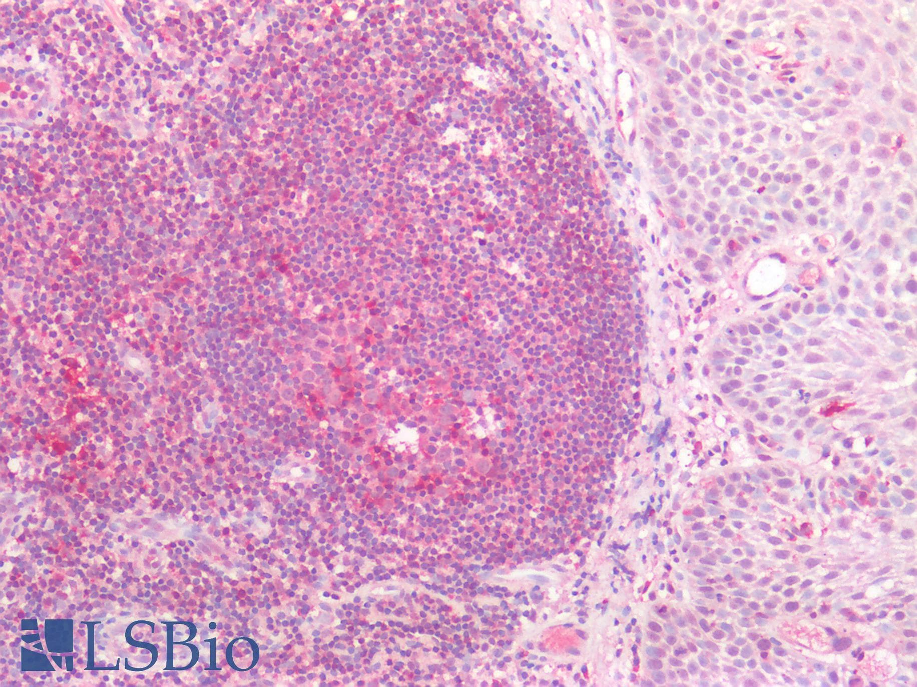 IHC-plus™ Polyclonal Rabbit anti-Human ATG16L1 / ATG16L Antibody (IHC)