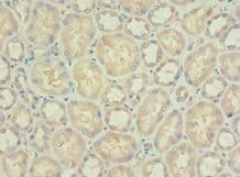 Polyclonal Rabbit anti-Human PDPK1 / PDK1 Antibody (aa277-556, IHC)