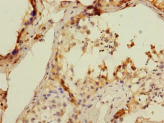 CD8B / CD8 Beta Antibody