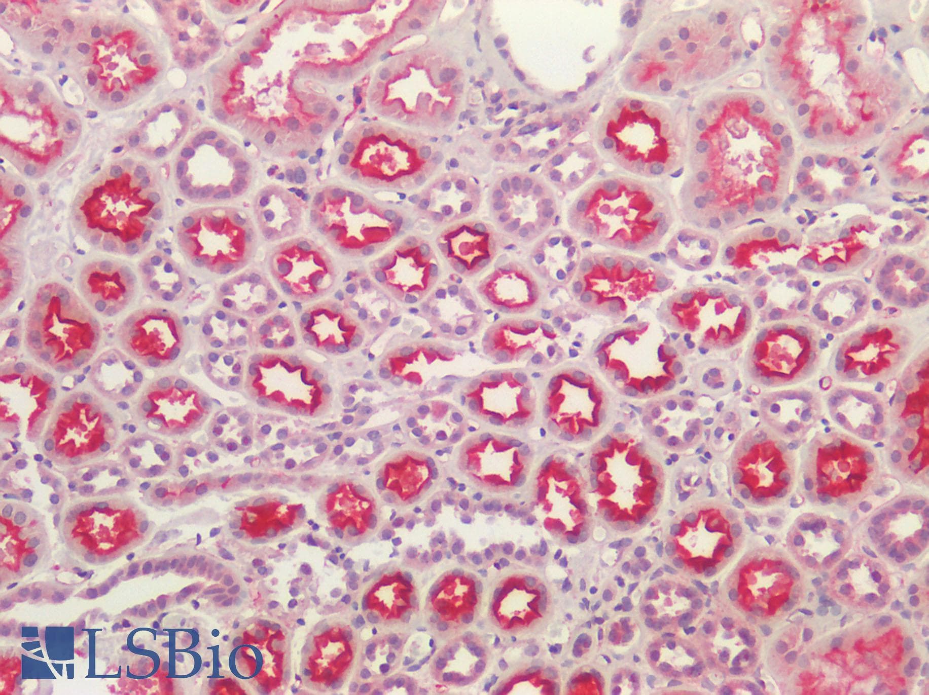 IHC-plus™ Polyclonal Rabbit anti-Human ACE / CD143 Antibody (IHC)