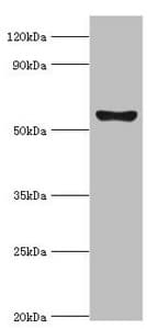 CYP2F / CYP2F1 Antibody (aa100-290)
