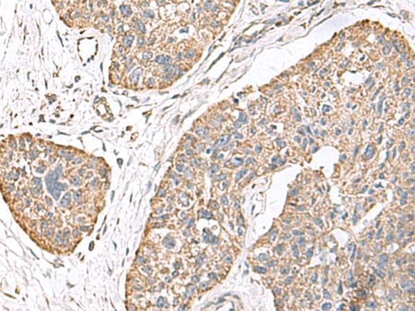 TMEM141 Antibody