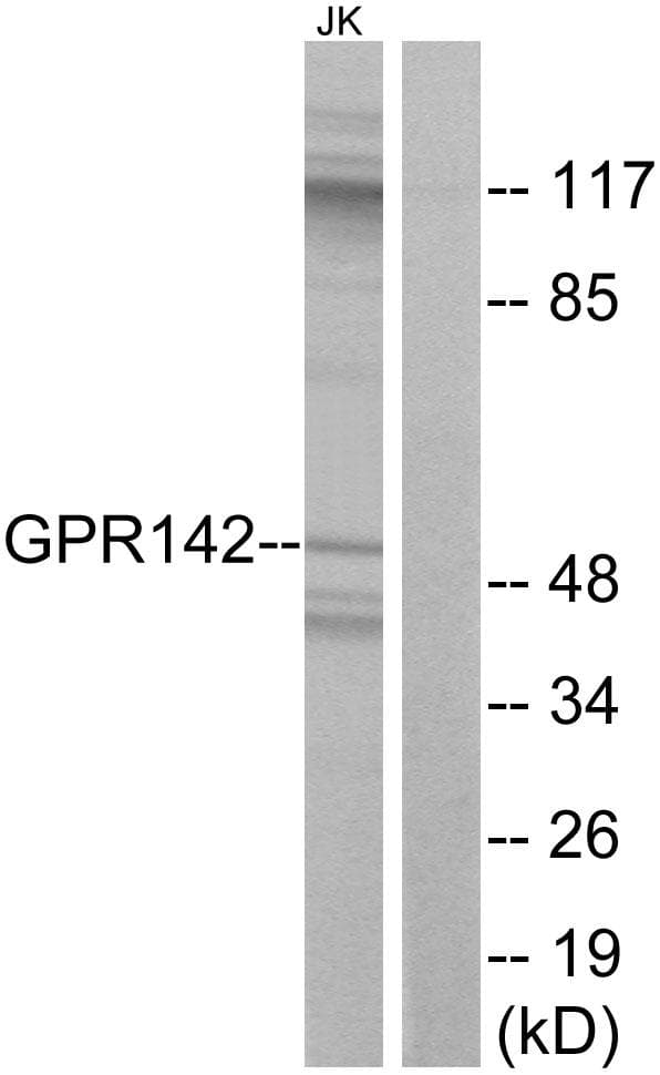 GPR142 Antibody
