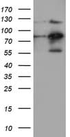 FOLH1 / PSMA Antibody (clone OTI2E1)