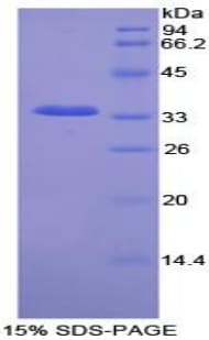 Rat NEK2 Protein (Recombinant His-T7)