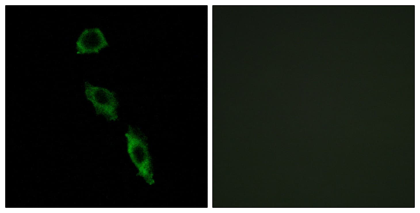 Polyclonal Rabbit anti-Human ERAS Antibody (aa184-233, IF, WB)