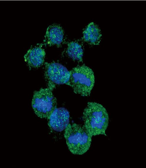 Polyclonal Rabbit anti-Human IL8 / Interleukin 8 Antibody (aa72-99, IHC, IF, WB)