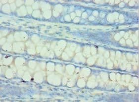 GLNRS / QARS Antibody (aa1-250)