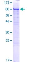Human LTV1 Protein (Recombinant GST)