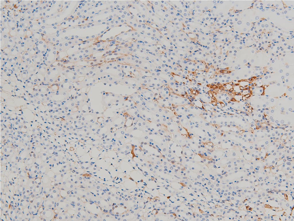 CFL1 / Cofilin Antibody (phospho-Ser3)