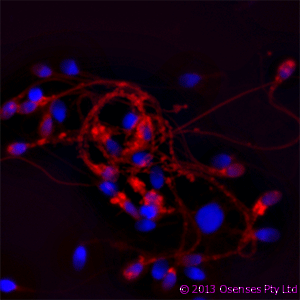 LL37 / Cathelicidin Antibody (clone OSX12)
