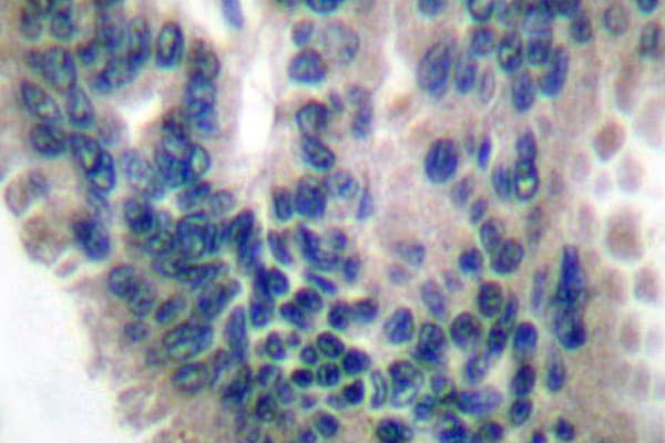 Polyclonal Rabbit anti-Human GUCY1B3 Antibody (Val21, IHC, WB)