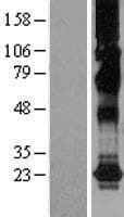 CHIC2 Protein (Over-Expression Lysate Myc-DDK (Flag))