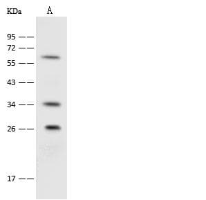 Polyclonal Rabbit anti-Human UCHL3 Antibody (IHC, WB)