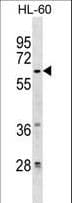 ZNF317 Antibody (aa173-199)