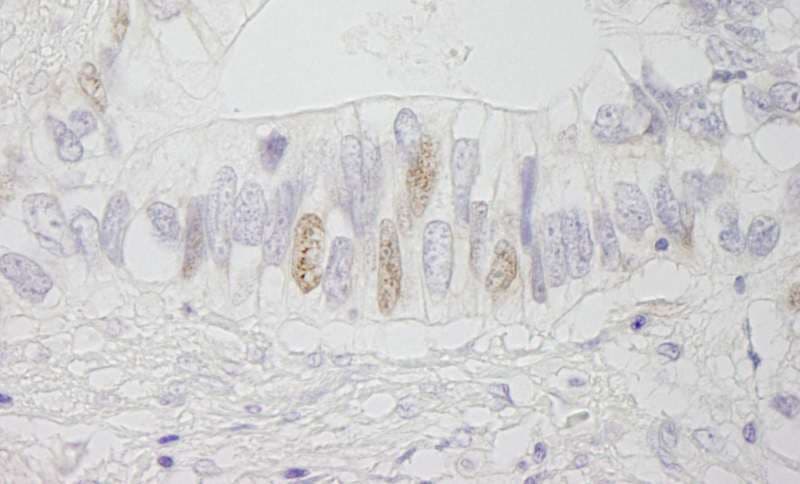 APC Antibody (aa1-50)