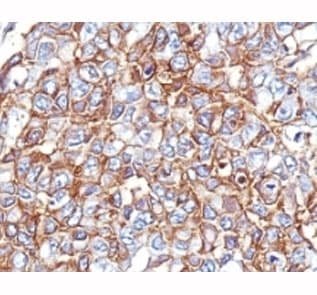 EPCAM Antibody (clone PAN-EpCAM)