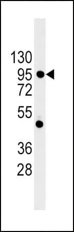 Polyclonal Rabbit anti-Human CDH1 / E Cadherin Antibody (aa160-189, WB)
