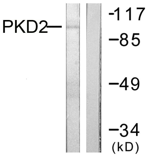IHC-plus™ PRKD2 / PKD2 Antibody (aa829-878)