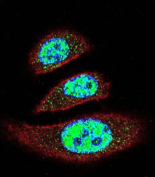 TDP2 / TTRAP Antibody (aa246-272)