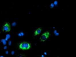 AGPAT5 Antibody (clone OTI2C4)