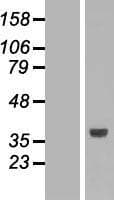 SLC25A3 Protein (Over-Expression Lysate Myc-DDK (Flag))