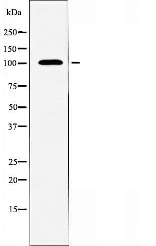Polyclonal Rabbit anti-Human KCNQ5 Antibody (IF, WB)