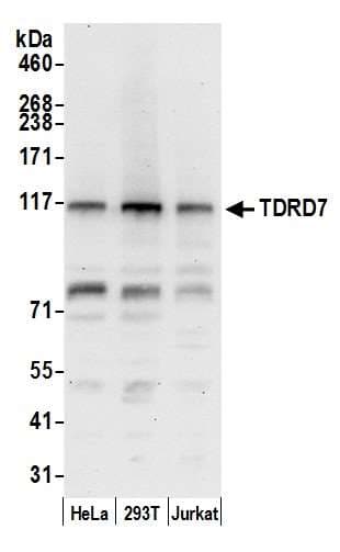 TDRD7 Antibody (aa1048-1098)