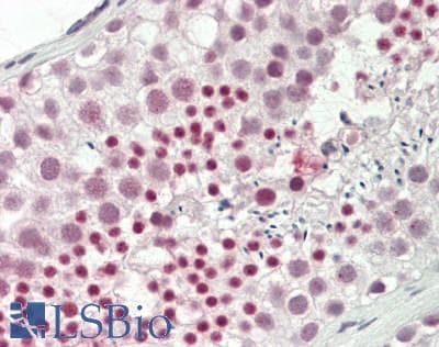 IHC-plus™ RBBP6 Antibody (clone 5A11)