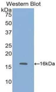 FABP1 / L-FABP Antibody (FITC)