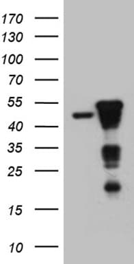 SMAP2 Antibody (clone OTI9B6)