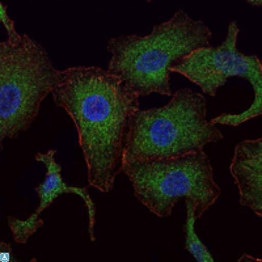 RAB25 Antibody