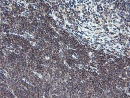 TPD52L3 Antibody (clone OTI7E10)
