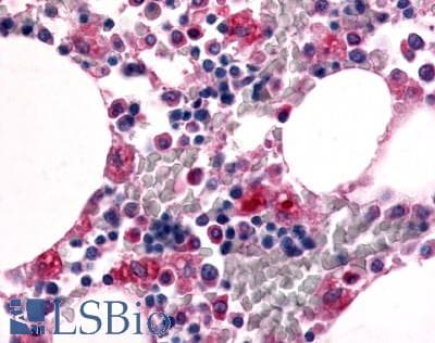 IHC-plus™ ADGRE1 / EMR1 Antibody (N-Terminus)