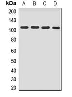 COPB1 / Beta-COP Antibody