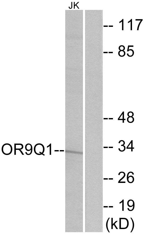 Polyclonal Rabbit anti-Human OR9Q1 Antibody (IF, WB)