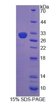 Rat COL9A1 / Collagen IX Protein (Recombinant)