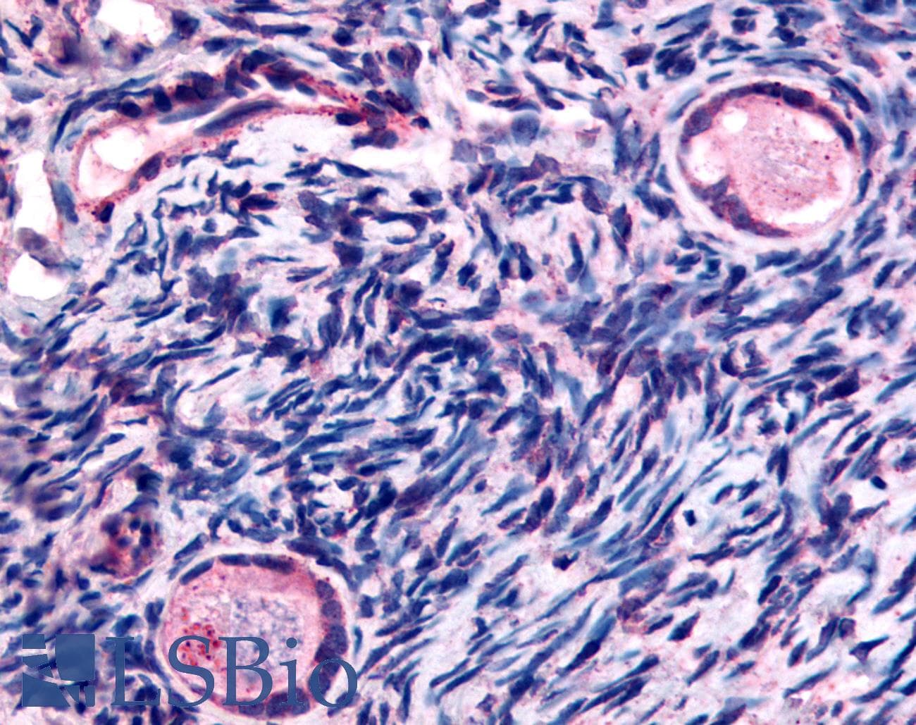 IHC-plus™ Polyclonal Rabbit anti-Human TMEM5 Antibody (Extracellular Domain, IHC)