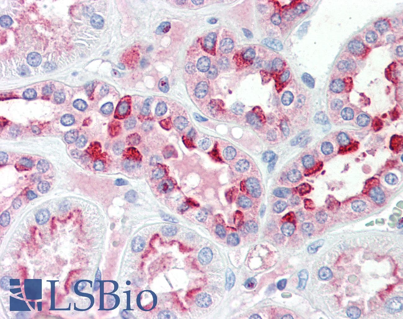 IHC-plus™ IDH3G Antibody (aa337-350)