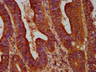 Polyclonal Rabbit anti-Human ALOX12 / 12 Lipoxygenase Antibody (IHC, IF, WB)