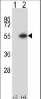 DTNBP1 / Dysbindin Antibody (aa10-38)
