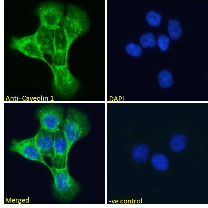 PathPlus™ Polyclonal Goat anti-Human CAV1 / Caveolin 1 Antibody (aa73-84, IHC, IF, WB)