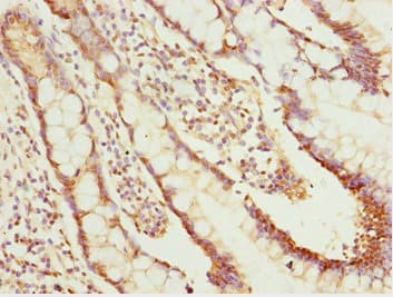 NLE1 Antibody