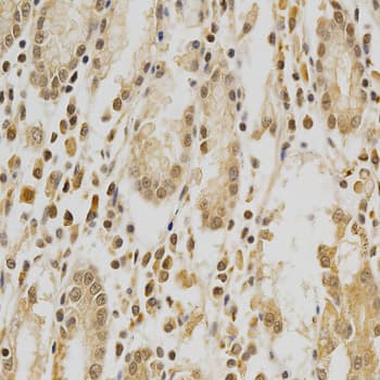 HDAC6 Antibody