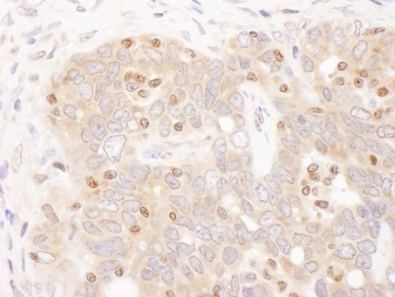TFEB Antibody (aa426-476)
