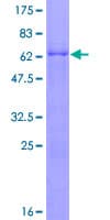 Human PHF6 Protein (Recombinant GST)